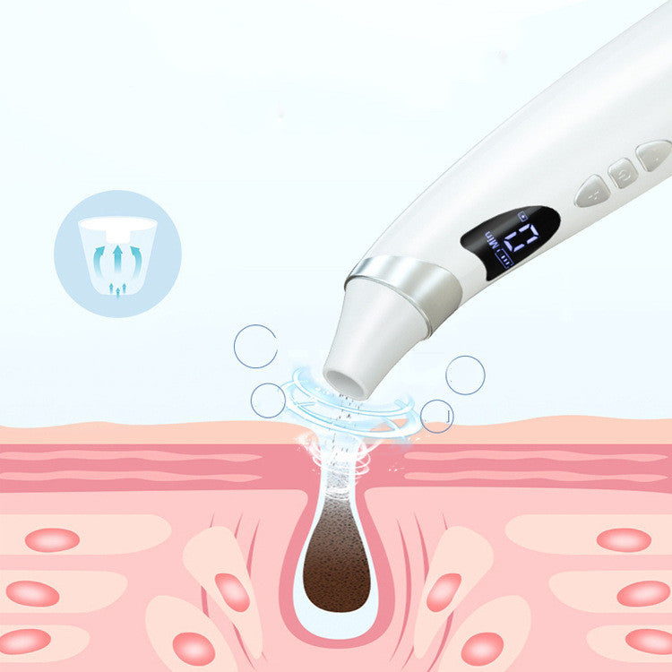Aspirateur de Points Noirs avec Caméra HD – Nettoyage en Profondeur Haute Précision