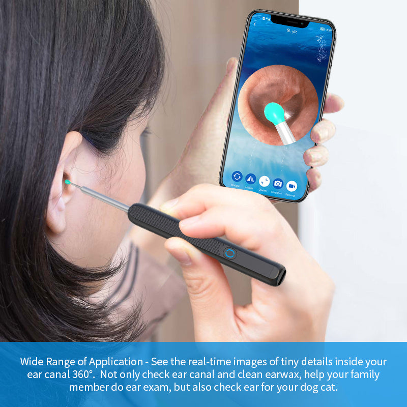 Nettoyeur d'Oreilles avec Caméra HD – Précision, Hygiène et Sécurité