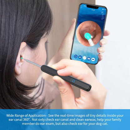 Nettoyeur d'Oreilles avec Caméra HD – Précision, Hygiène et Sécurité
