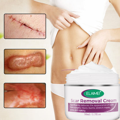 Crème Réparatrice Peau & Vergetures – Effet Anti-Cicatrices, Anti-Imperfections