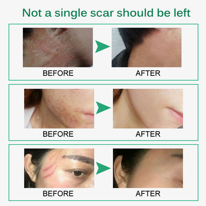 Crème Réparatrice Peau & Vergetures – Effet Anti-Cicatrices, Anti-Imperfections